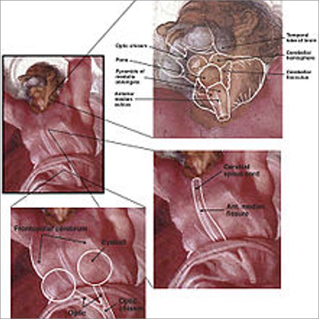 Frame overview