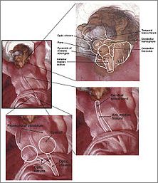 Frame overview